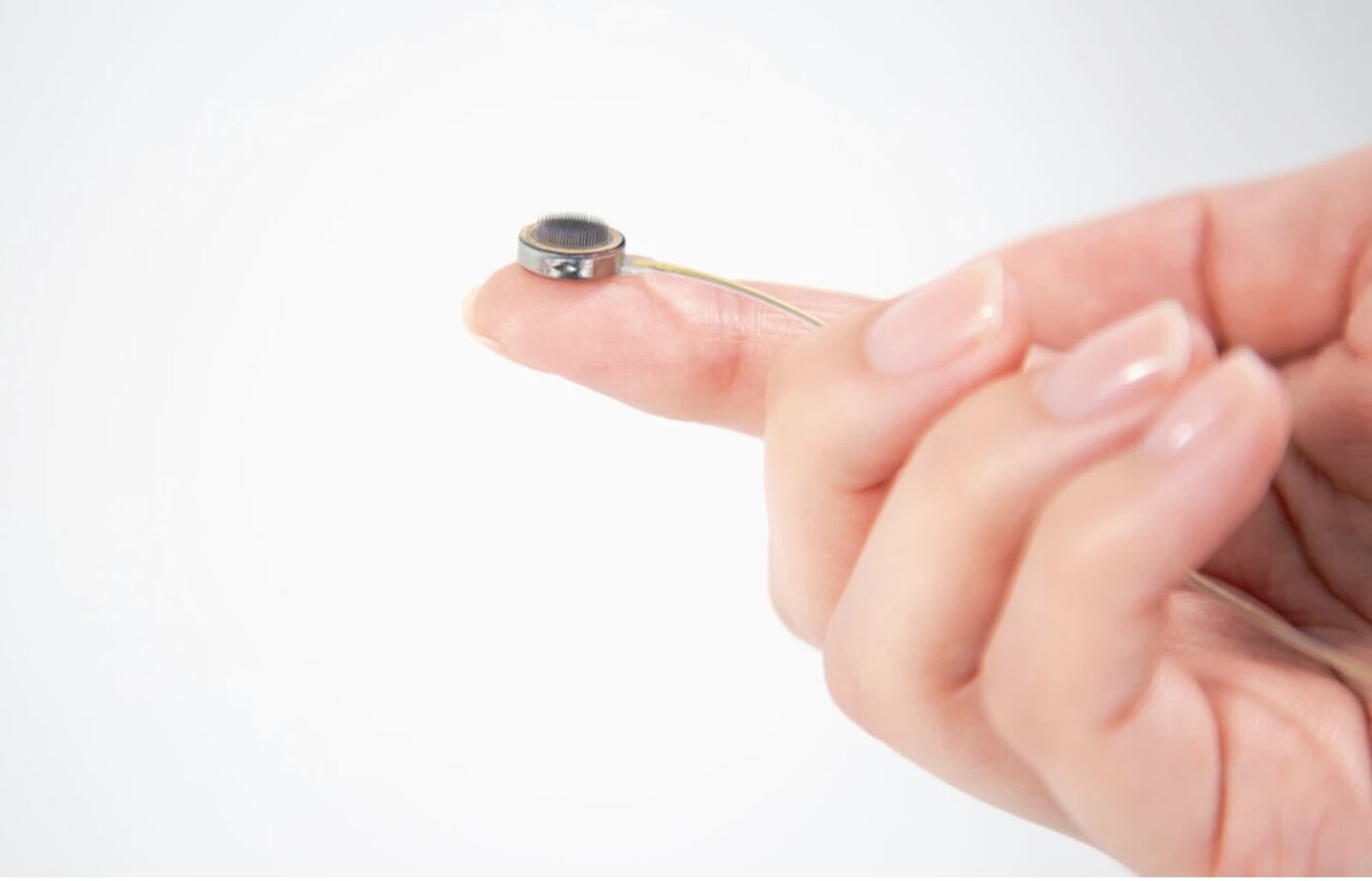 “انقلابی در پزشکی: تراشه‌ای که صدای افراد فلج را بازمی‌گرداند!”